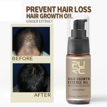Galingas Plaukų Augimo Esmė Plaukų Slinkimas Produktų Eterinis Aliejus Skystas Gydymo Prevencijos Pomade Nuostolių Plaukų Priežiūros Produktų